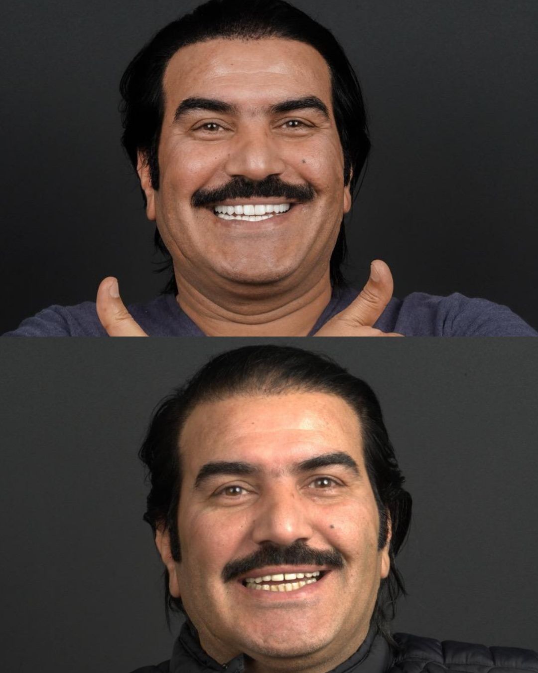 Dental before after