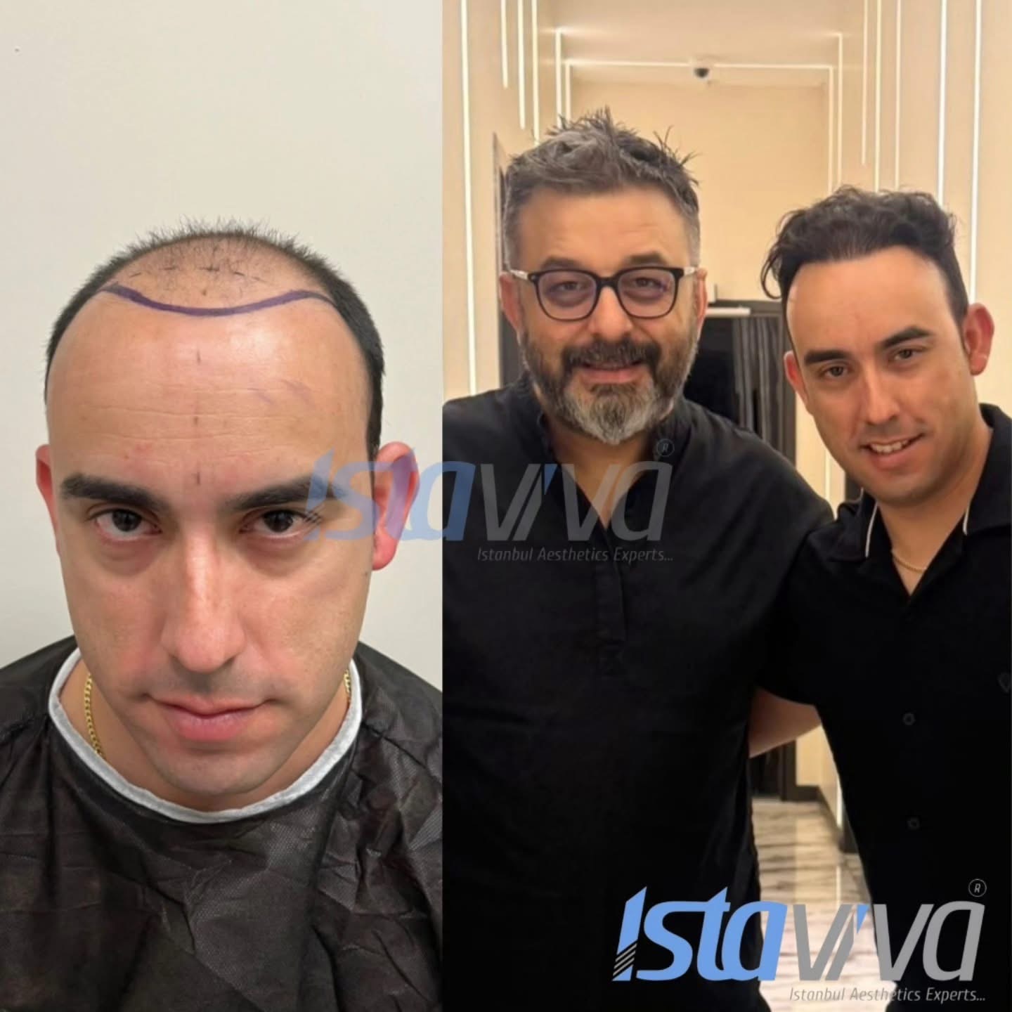 Emre Menekşe and client